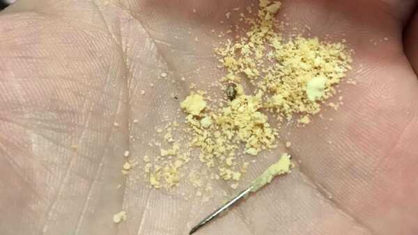 Hambre Cero: Padre denuncia hallazgo de una aguja en chipita de la merienda escolar