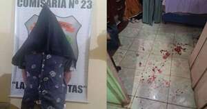 Diario HOY | Atacó con machetillo a dos mujeres tras intentar besar a la fuerza a una niña