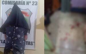 ¡Como poseído! Quiso besar a la fuerza a una menor y todo acabó en un reguero de sangre