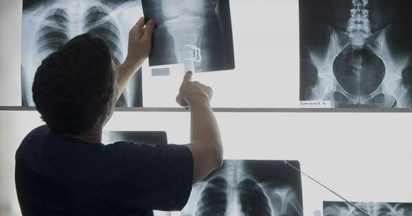 Diario HOY | Sobredemanda de alumnos y poca salida laboral: la realidad de Radiología y otras carreras