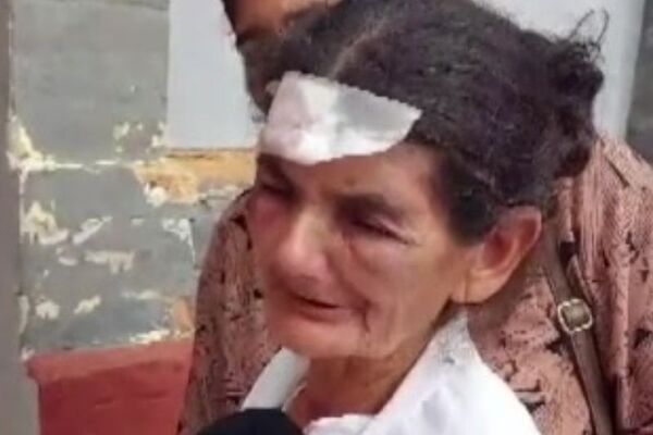 Denuncian brutal agresión a anciana por parte de sus hijos en Caazapá - SNT