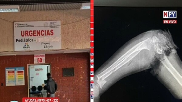 Bebé metió el brazo en una centrifugadora y casi lo pierde