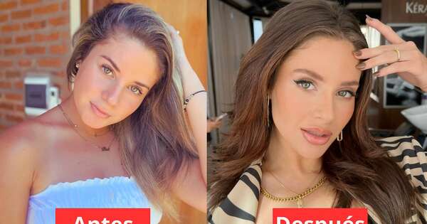 La Nación / ¿Es recomendable? Con 22 años, influencer presume retoques estéticos