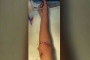 Niño casi pierde el brazo al meterlo en una centrifugadora en Presidente Franco - SNT