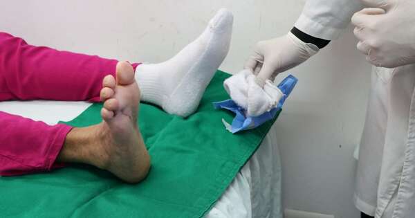 La Nación / Clínicas: dan alta médica a paciente que recibió tratamiento con larvas de mosca y parche biológico