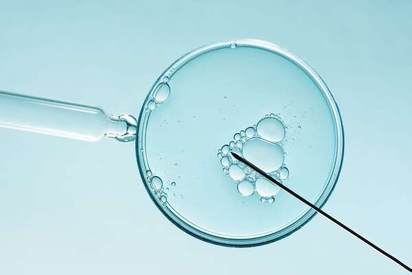 Error in vitro: habrían colocado un embrión equivocado a una madre en Australia - Ciencia - ABC Color