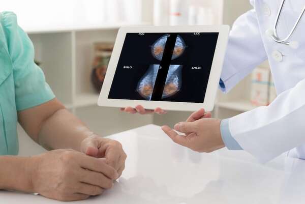 Cáncer de Mamas: no existe un registro nacional de pacientes y hay pocos datos - Nacionales - ABC Color