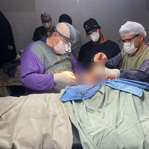 Exitoso primer reimplante de brazo en paciente pediátrico - 1000 Noticias
