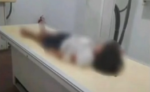 Padre denuncia negligencia médica tras cirugía de su hija en el Hospital de Clínicas - Noticiero Paraguay