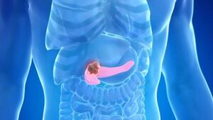 Investigadores identifican una de las claves de la agresividad del cáncer de páncreas