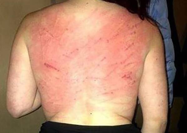 Mujer corría por la calle, casi desnuda, pidiendo socorro: un “loco sexual” la maltrató