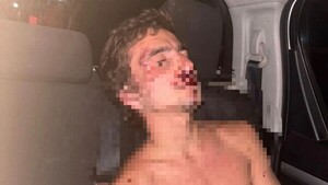 Conductor de Bolt fue brutalmente golpeado por un artemarcialista