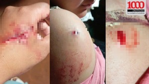 Discusión entre primas terminó con un ataque a punta de cuchillo - 1000 Noticias