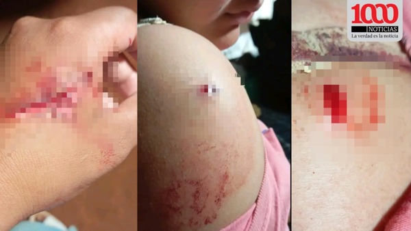 Discusión entre primas terminó con un ataque a punta de cuchillo - 1000 Noticias