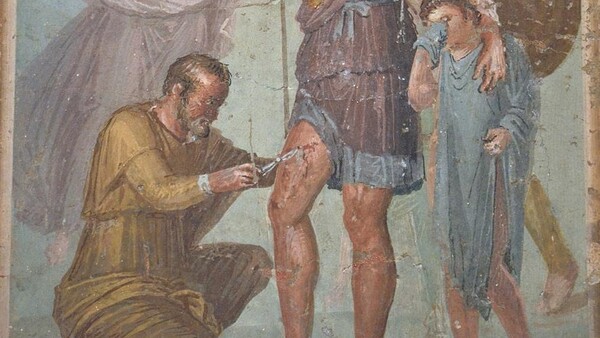 Medicina en la antigua Roma: Los sorprendentes y peligrosos métodos médicos - ADN Digital
