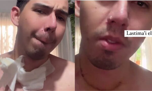 (VIDEO) “¡Contenido sensible!”: ¿Qué le pasó al influencer “Soy Elías”?