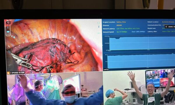 (Video) Cirujano opera desde China a un paciente en Rumania con tecnología 5G