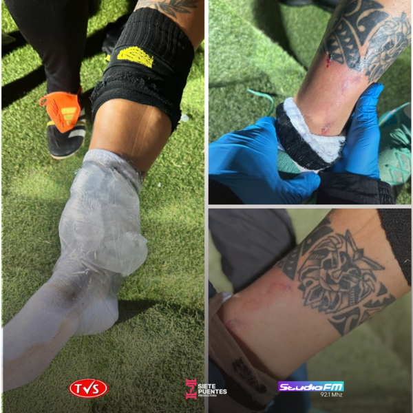 GUARANÍ DE FRAM: JUGADOR HOSPITALIZADO, UN EXPULSADO Y LA VICTORIA ARREBATADA - TVS