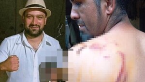 Denuncian a padre de futbolista por agredir a un obrero con botella rota