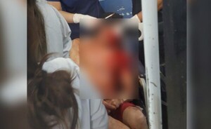Exconvicto fue herido de un machetazo en el rostro en el Km 10 Acaray