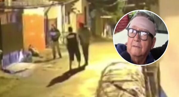 Agredido por chespis en su propia casa en Fernando de la Mora - SNT