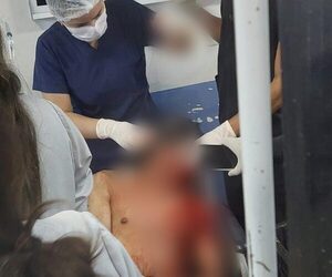 Atacan e hieren a sujeto con frondosos antecedentes