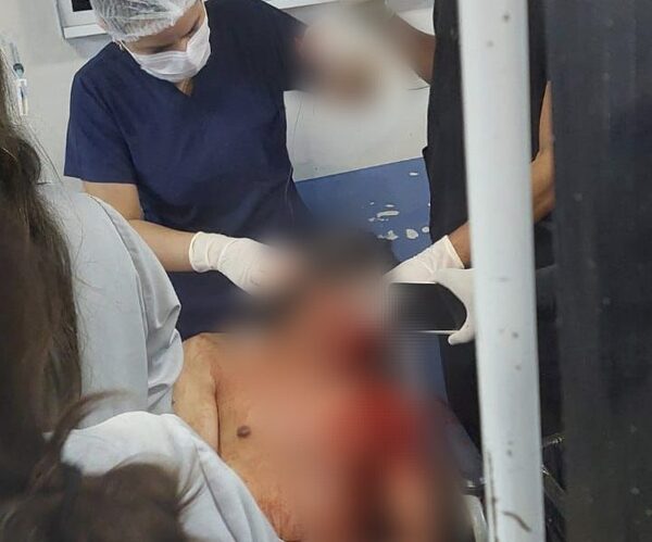 Atacan e hieren a sujeto con frondosos antecedentes