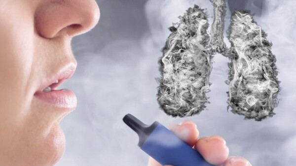 Los vapeadores aumentan el riesgo de cáncer de cabeza y cuello en las personas