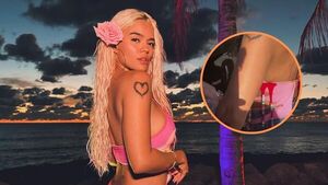 ¡Karol G sufrió un accidente durante sus vacaciones y mostró las heridas!