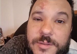 ¡¿Qué le agarró a José Ayala?! “Por lo menos ya sé lo que es y cómo tratar”