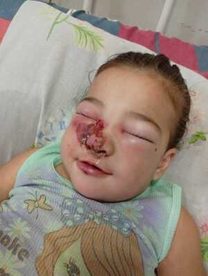 Emily, una pequeña guerrera de 1 año, lucha por su vida en Asunción