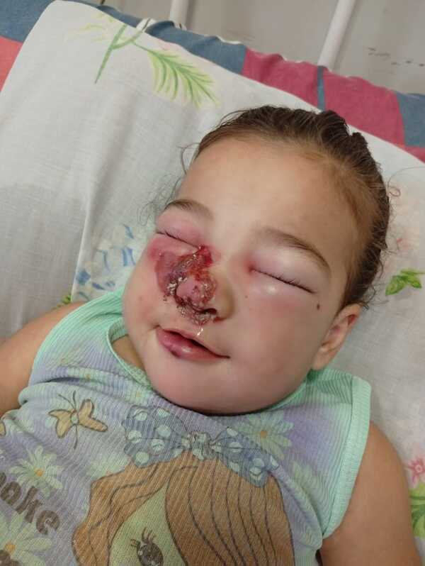 Emily, una pequeña guerrera de 1 año, lucha por su vida en Asunción