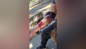 Mujer resulta herida tras incidente en inquilinato de Encarnación