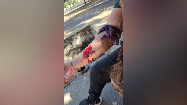 Mujer resulta herida tras incidente en inquilinato de Encarnación