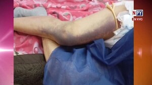 Finalmente paciente de 78 años será operado el lunes en IPS Ingavi