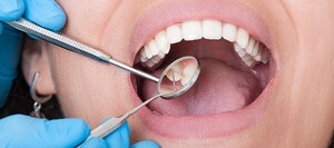 Caries Cero en las Escuelas": Salud Bucodental como aliada de Hambre Cero