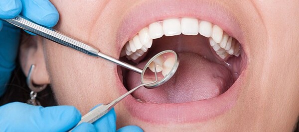 Caries Cero en las Escuelas": Salud Bucodental como aliada de Hambre Cero