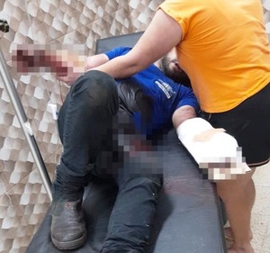 Trabajador resulta herido tras explosión de congelador - La Clave