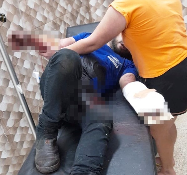 Trabajador resulta herido tras explosión de congelador - La Clave