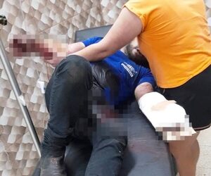 Explotó congelador y un trabajador quedó con graves heridas