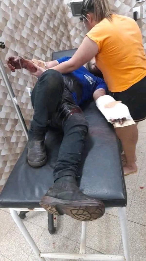 Técnico de refrigeración herido luego de que congeladora explotara en Hernandarias - 1000 Noticias