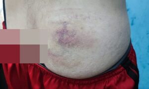 Pelean por droga en cárcel de CDE