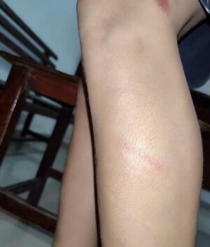 Ñato fue apresado por golpear a un niño con un palo de escoba