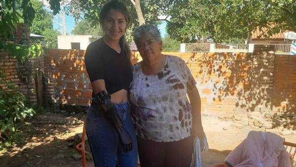 Regalaron una prótesis a joven que perdió la mano en un intento de feminicidio