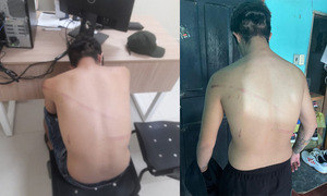 Denuncian abuso de agentes Lince en Coronel Oviedo: víctima acusa robo y agresión - OviedoPress