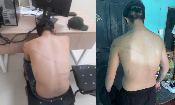 Denuncian abuso de agentes Lince en Coronel Oviedo: víctima acusa robo y agresión - OviedoPress