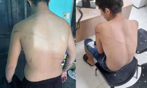 Linces habrían agredido, robado y amenazado a un joven en Coronel Oviedo – Prensa 5