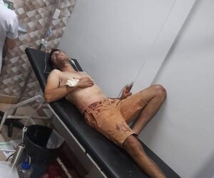 Balean a hombre con antecedente policial