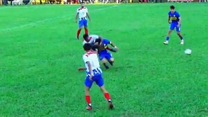 Video: Dura lesión dejó con feroz moretón en la cara a jugador de Santa Rosa del Aguaray