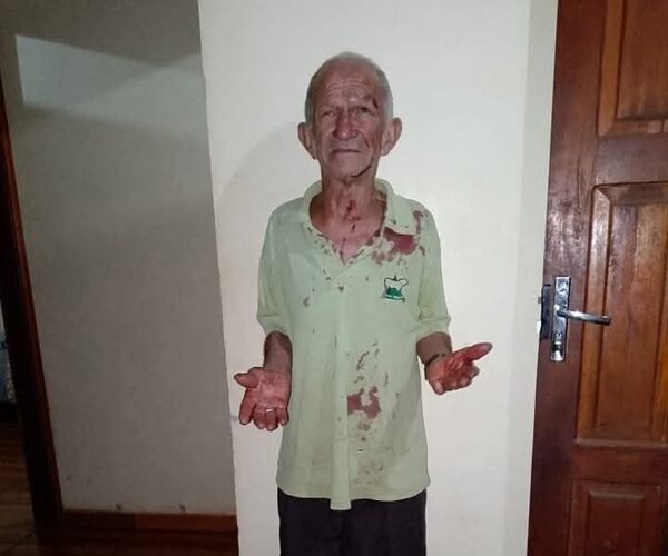 Abuelo denunció que su yerno lo molió a golpes